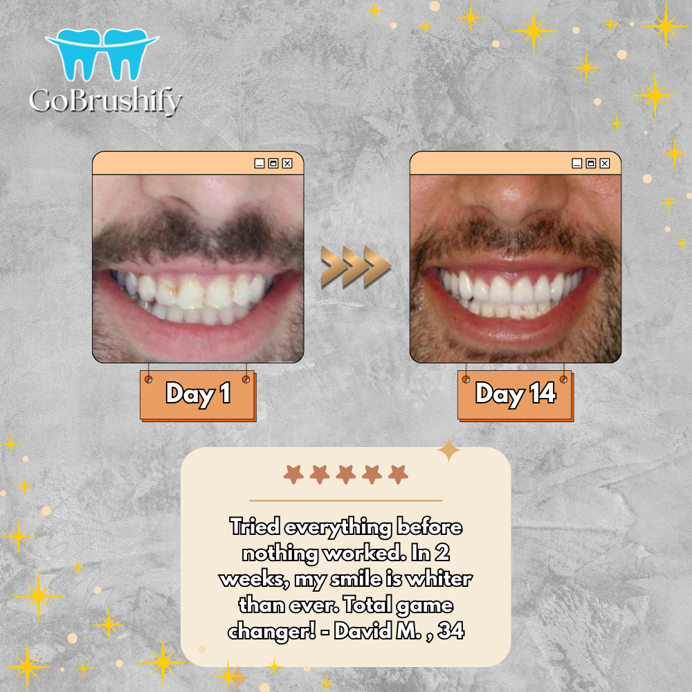 GoBrushify™ Sonic Toothbrush