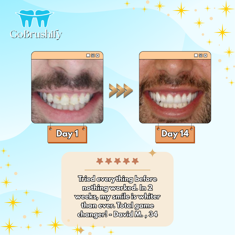 GoBrushify™ Sonic Toothbrush